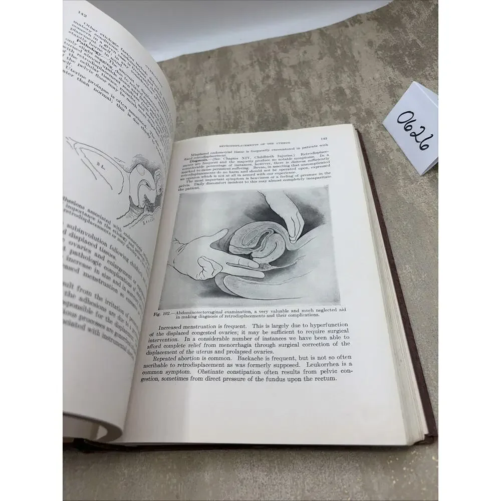 TEXTBOOK OF GYNECOLOGY 2nd Edition of 1931 By Arthur Hale Curtis